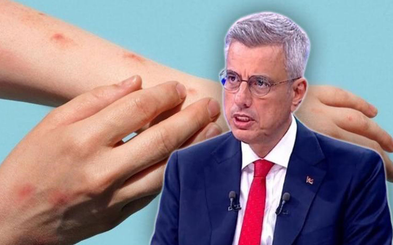 Bakan Memişoğlu’ndan maymun çiçeği açıklaması